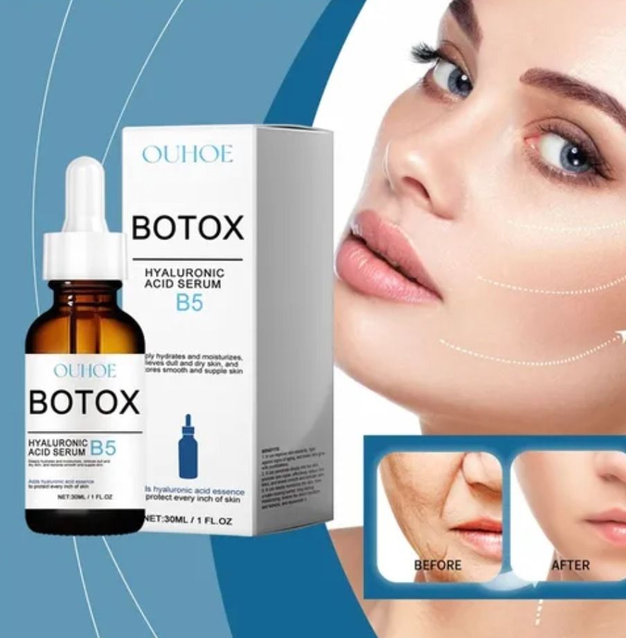 BOTOX B5™ — Ácido hialurónico + B5 para hidratar y reafirmar el rostro 💧✨